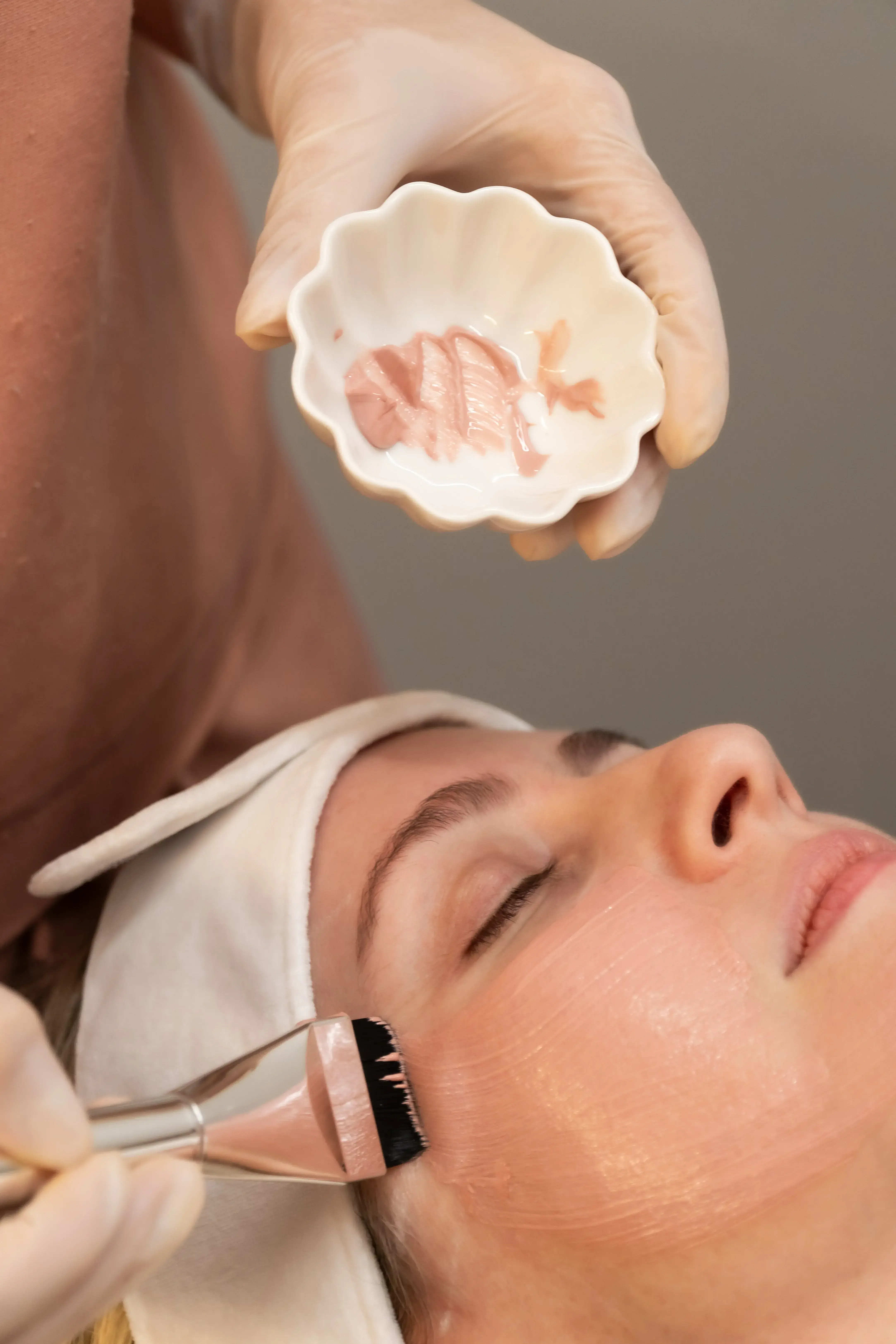 Tratamento Peelings - Tratamentos de renovação celular através de peelings químicos personalizados.